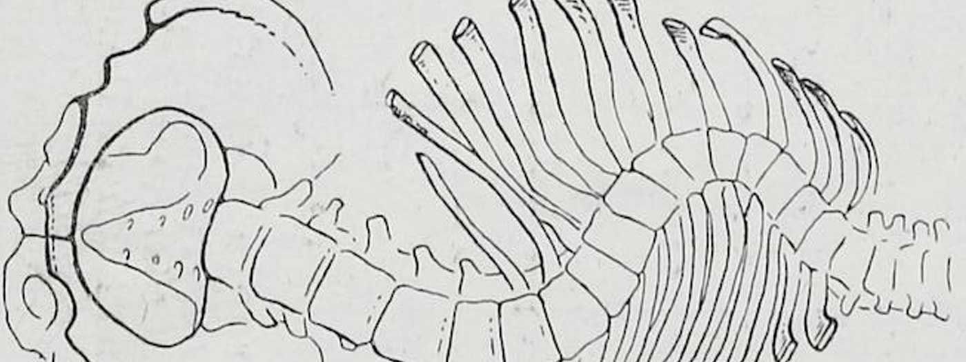 Escoliosis y la quiropractica